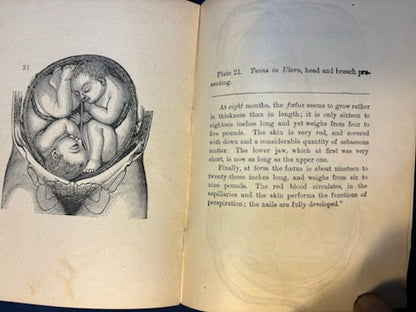 Sauer, P. B.  Maternity. Chicago: Miller, 1891. Revised ed. Pamphlet of graphic plates laid in. Pict cloth, gilt. Very Good