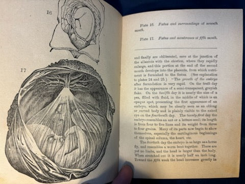 Sauer, P. B.  Maternity. Chicago: Miller, 1891. Revised ed. Pamphlet of graphic plates laid in. Pict cloth, gilt. Very Good