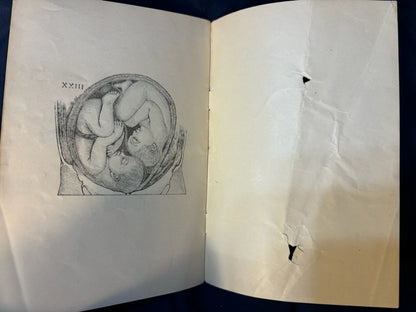 Stockham, Alice.  Tokology. Chicago: Sanitary Pub, 1886. Revised Ed. Pamphlet of plates in pocket. Pict cloth, gilt. Light foxing. Rear hinge cracked.Very Good